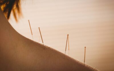 Akupunktura: starożytna technika leczenia dla współczesnego świata